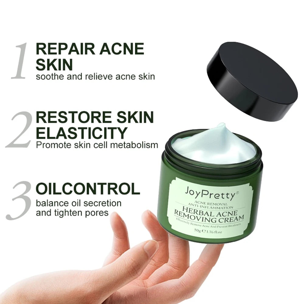 JoyPretty Herbal Acne Face Cream Body Pimple Treatment