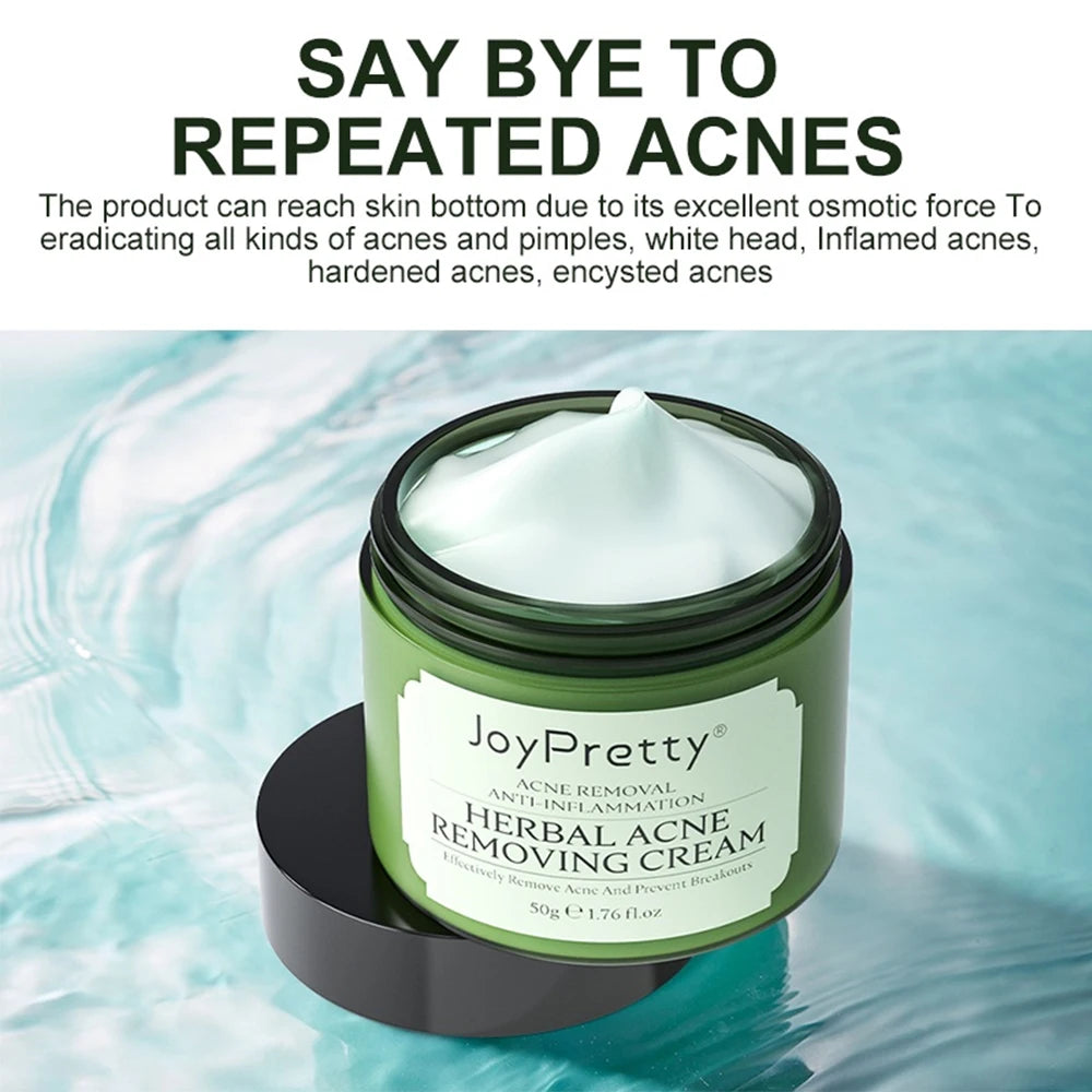 JoyPretty Herbal Acne Face Cream Body Pimple Treatment