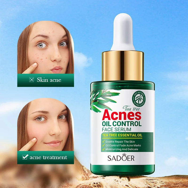 SADOER Tea  Tree Acne Oil